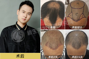 �Ͼ�����ֲ���ò��ã�����ֲ����ͼ������