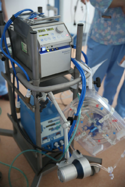 ҽԺħΡ(ECMO)С顪